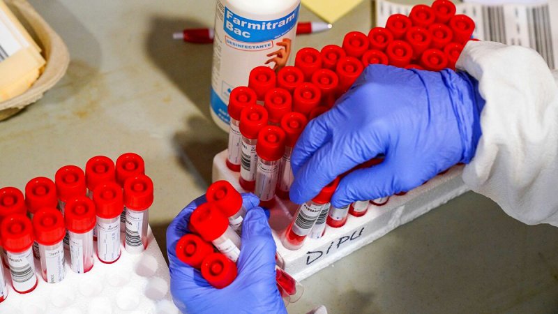 Türkiye ile Sırbistan arasında PCR testi zorunluluğu kaldırıldı