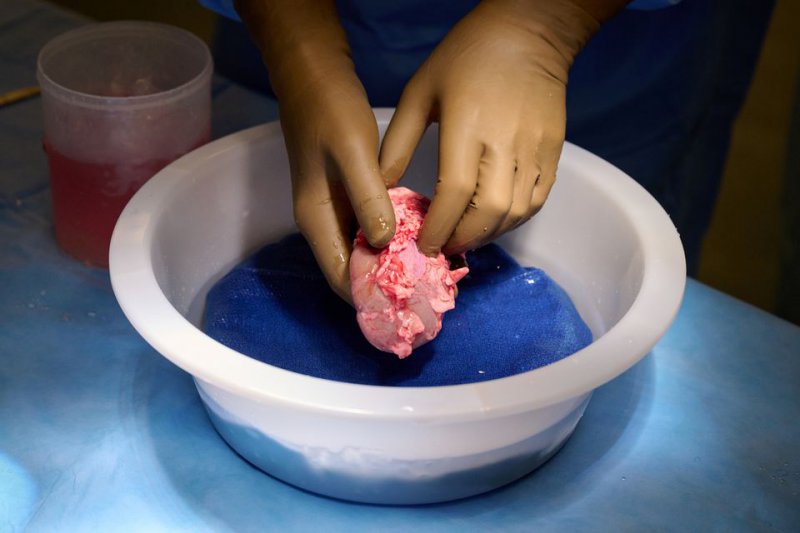 İlk kez domuzdan insana organ nakli yapıldı