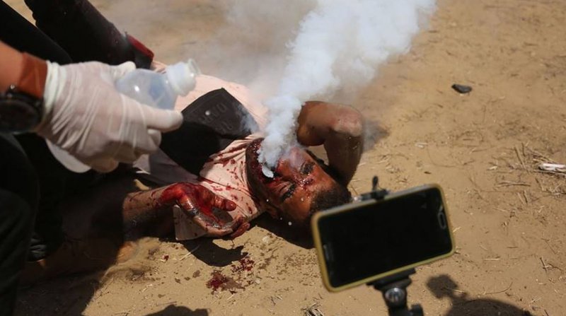 Ağzına gaz bombası isabet eden Filistinli Heysem: İsrail tedavimi engelliyor