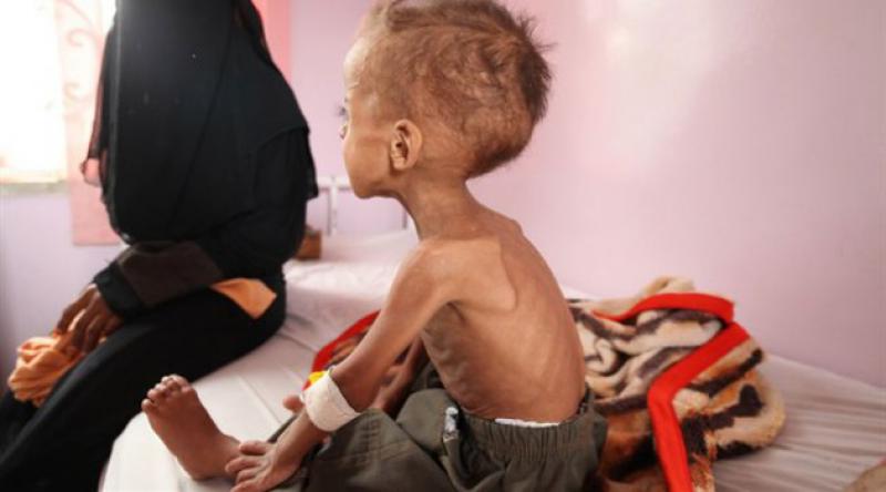 Açlıktan ölümlerin yaşandığı Yemen'in Hudeyde kentinden acı tablo