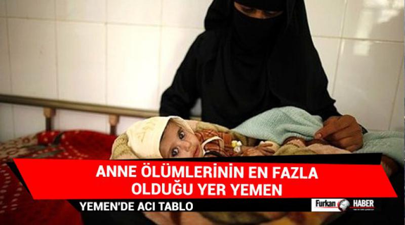 Anne ölümlerinin en fazla olduğu yer Yemen