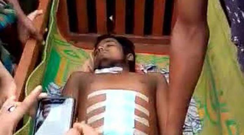 Bangladeşli Müslüman Gencin İç Organlarını Çaldılar