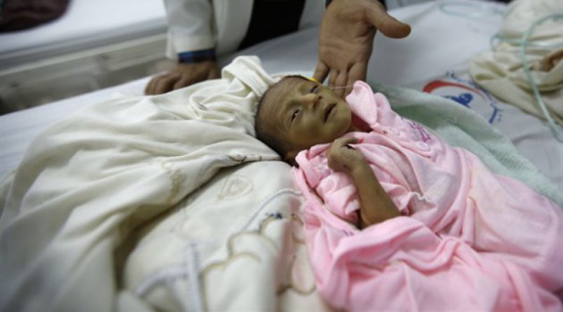 Birleşmiş Milletler'den Yemen&#39;de "Kıtlık Riski&quot; Uyarısı