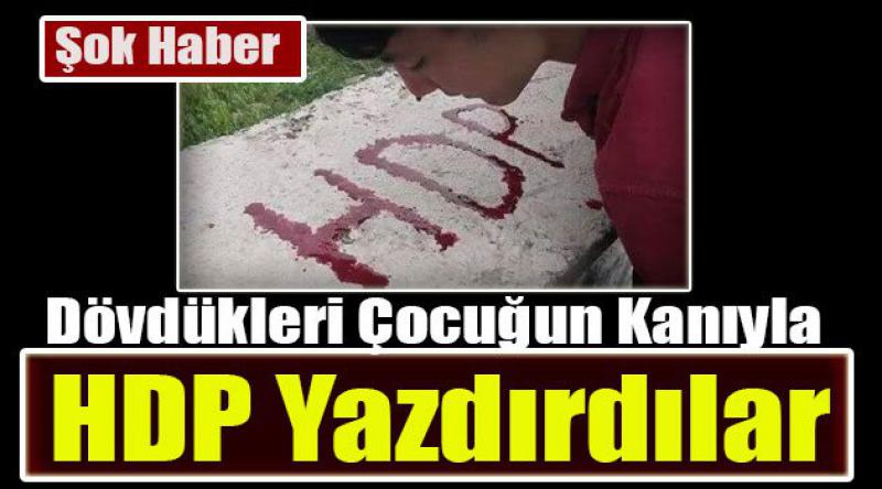 Dövdükleri Çocuğun Kanıyla HDP Yazdırdılar