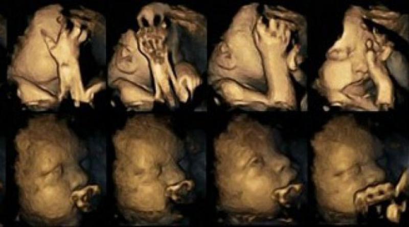 Hamilelikte 'sigara&#39; bebeği böyle etkiliyor