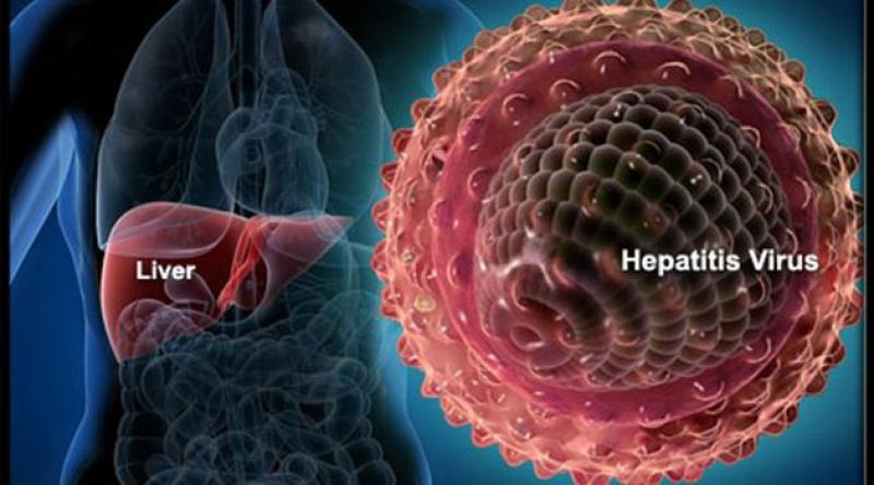 Hepatit yılda 1,4 milyon can alıyor