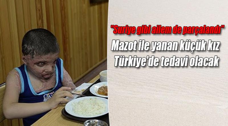 Mazot ile yanan küçük kız Türkiye'de tedavi olacak