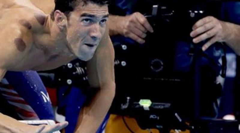 Michael Phelps'teki izlerin sırrı belli oldu!