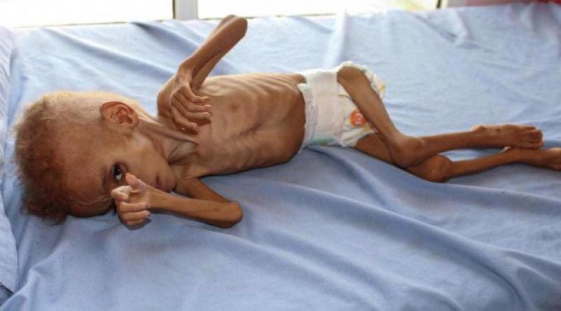 'Milyonlarca Yemenli aç uyuyor&#39;