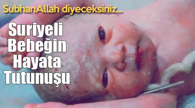 SubhanAllah diyeceksiniz... Suriyeli Bebeğin Hayata Tutunuşu
