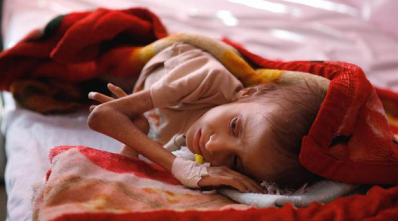 UNICEF: Yemen'de 10 dakikada 1 çocuk ölüyor