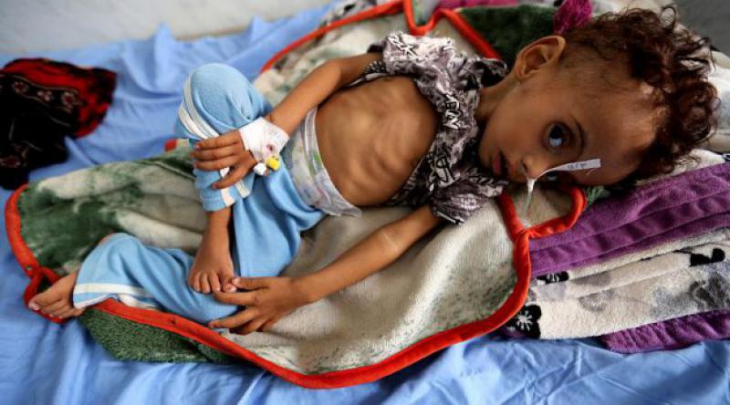 Yemen'de 14 milyon insan açlıktan ölme riski ile karşı karşıya
