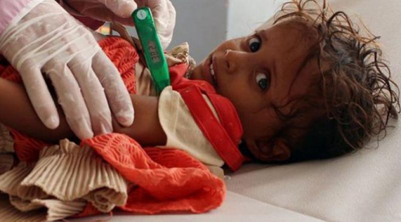 Yemen'de tehlike büyüyor: İki buçuk ayda 109 bin kolera vakası